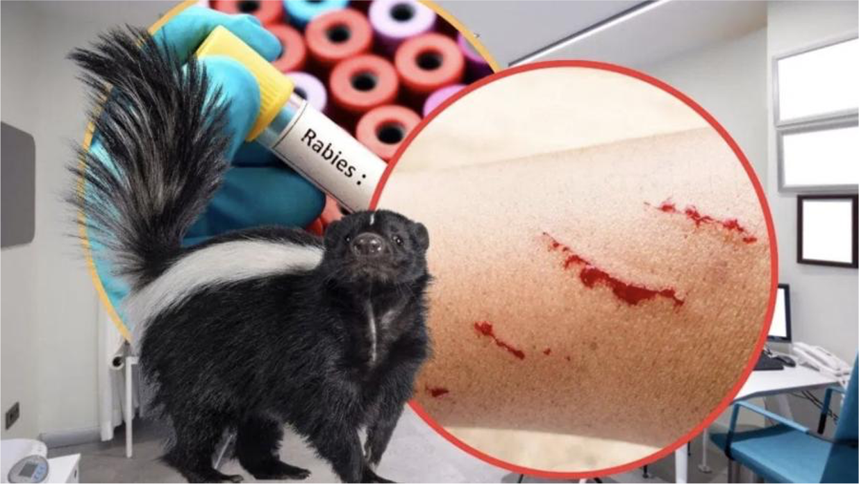 Zacatecas registra primera muerte por rabia desde 1987: todo lo que debes saber